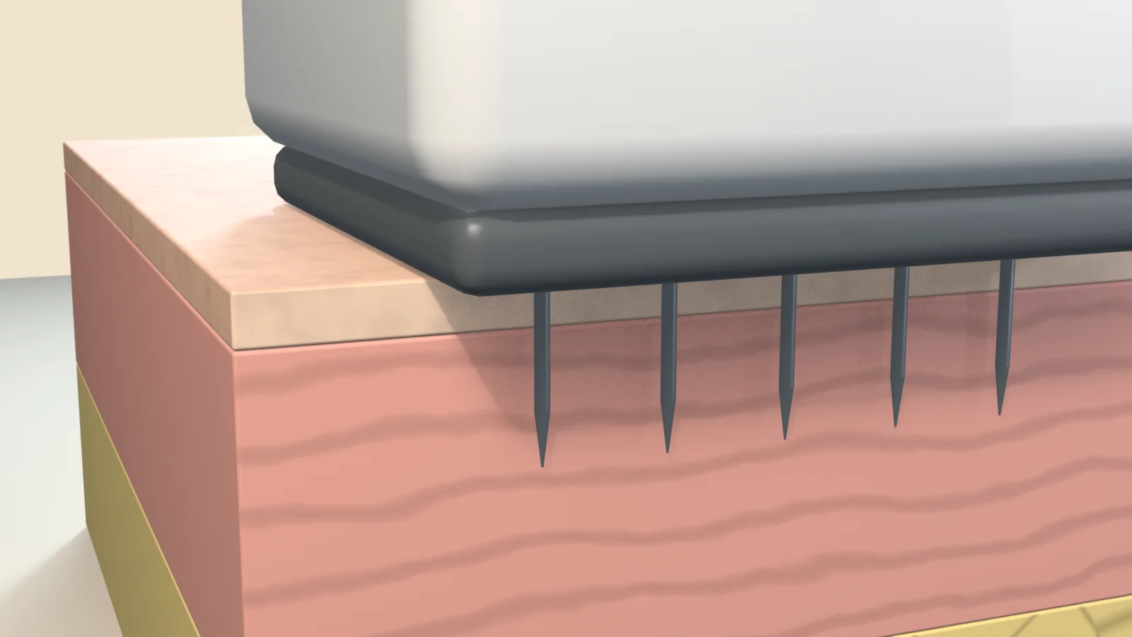 Skin cross-section with a microneedling cartridge resting on the surface and its fine needles reaching through the surface layer into the dermis